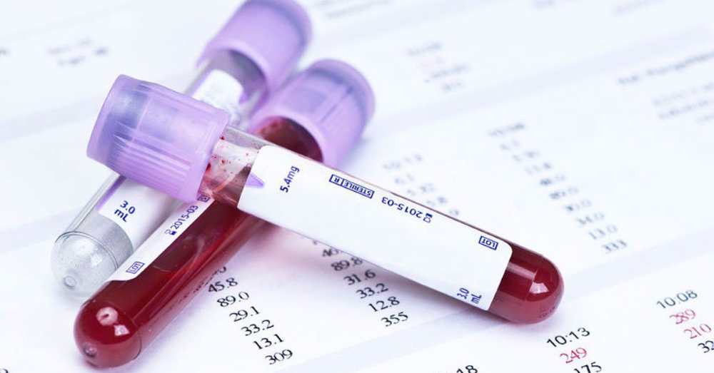 Ampulky s krví na test na THC 